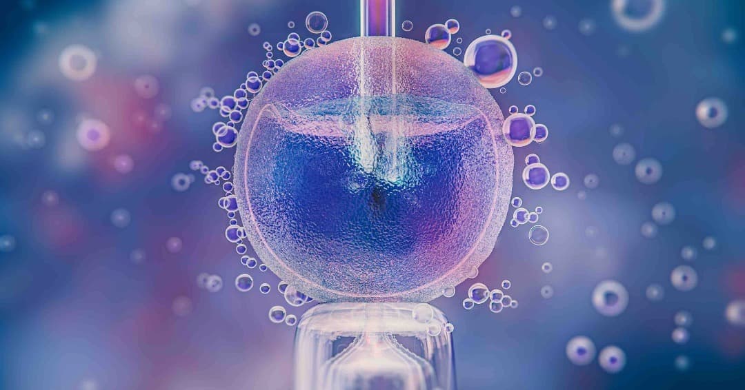 In Vitro Fertilization