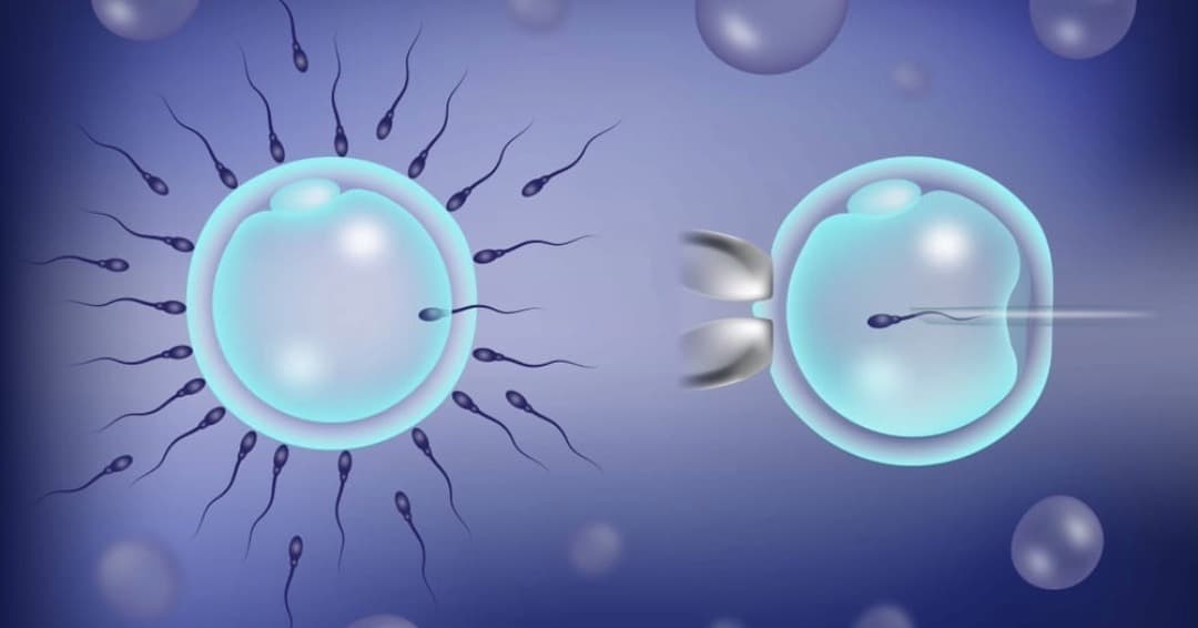 Intrauterine Insemination